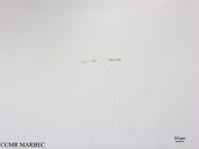 phyto/Brazilian_Nordeste/FernandodeNoronha_station1/ABRACOS1 October 2015/Chaetoceros pelagicus (Snap-1057)(copy)_thumb.jpg